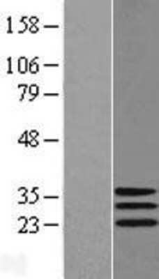 Western Blot: DNAJC30 Overexpression Lysate [NBL1-09953]