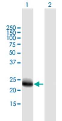 Western Blot: DNAJC5B Antibody [H00085479-B01P]