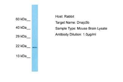 Western Blot: DNAJC5B Antibody [NBP2-84808]