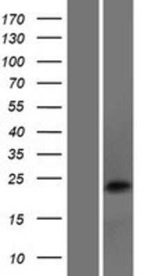 Western Blot: DNAJC5B Overexpression Lysate [NBP2-05922]