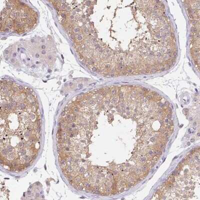 Immunohistochemistry: DNAJC5G Antibody [NBP2-38484]