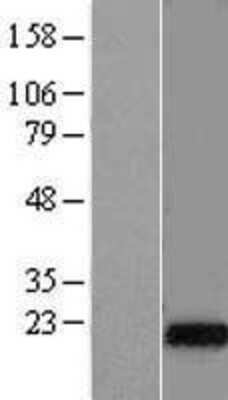 Western Blot: DNAJC5G Overexpression Lysate [NBL1-09955]