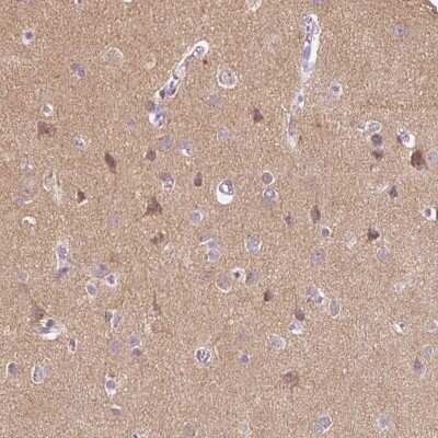 Immunohistochemistry-Paraffin: DNAJC6 Antibody [NBP1-81507]