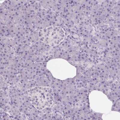 Immunohistochemistry-Paraffin: DNAJC6 Antibody [NBP1-81507]