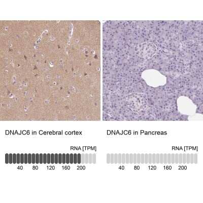 Immunohistochemistry-Paraffin: DNAJC6 Antibody [NBP1-81507]