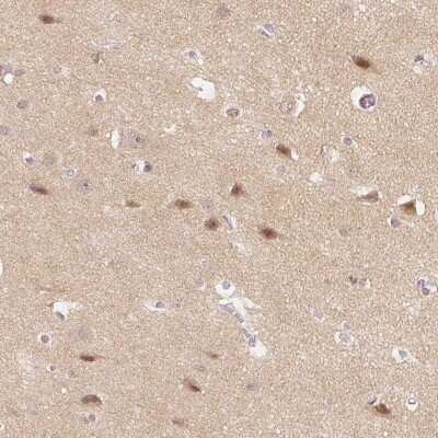 Immunohistochemistry-Paraffin: DNAJC6 Antibody [NBP2-38742]