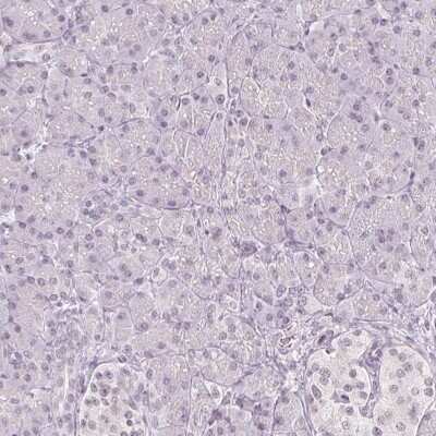 Immunohistochemistry-Paraffin: DNAJC6 Antibody [NBP2-38742]