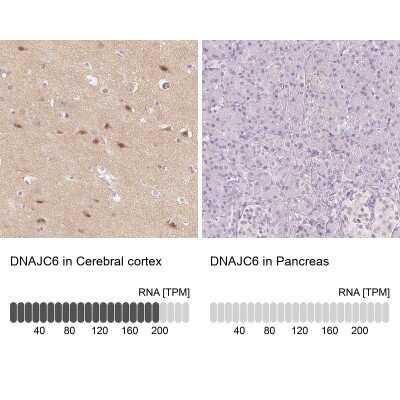 Immunohistochemistry-Paraffin: DNAJC6 Antibody [NBP2-38742]