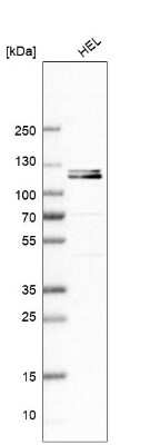 Western Blot: DNAJC6 Antibody [NBP1-81507]