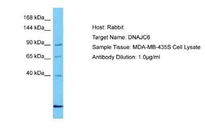 Western Blot: DNAJC6 Antibody [NBP2-87291]