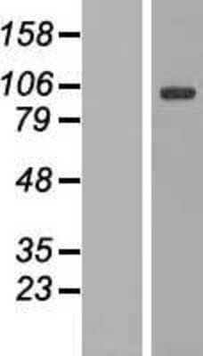 Western Blot: DNAJC6 Overexpression Lysate [NBP2-07267]