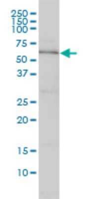 Western Blot: DNAJC7 Antibody (4G6-G3) [H00007266-M01]