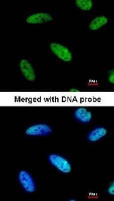 Immunocytochemistry/ Immunofluorescence: DNAJC7 Antibody [NBP1-32127]