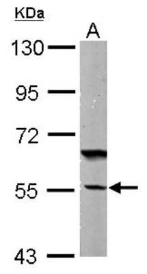 Western Blot: DNAJC7 Antibody [NBP1-32127]