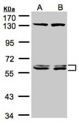 Western Blot: DNAJC7 Antibody [NBP1-32127]