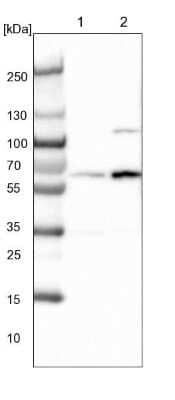 Western Blot: DNAJC7 Antibody [NBP1-86920]