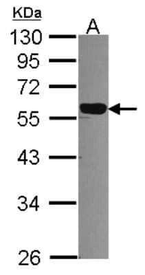 Western Blot: DNAJC7 Antibody [NBP2-16196]