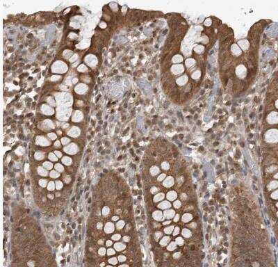 Immunohistochemistry-Paraffin: DNAJC8 Antibody [NBP1-87015]