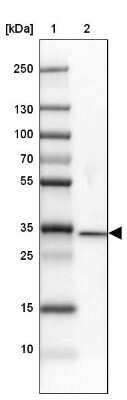 Western Blot: DNAJC8 Antibody [NBP1-87015]