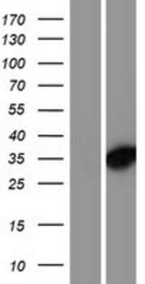 Western Blot: DNAJC8 Overexpression Lysate [NBP2-07360]