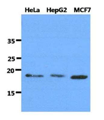 Western Blot: DNAL1 Antibody (29E4)BSA Free [NBP2-42657]