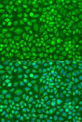 Immunocytochemistry/ Immunofluorescence: DNAL1 Antibody - BSA Free [NBP2-92922]