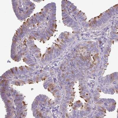 Immunohistochemistry-Paraffin: DNAL1 Antibody [NBP2-13929]