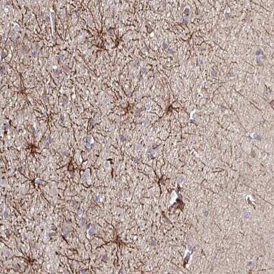 Immunohistochemistry-Paraffin: DNAL1 Antibody [NBP2-13929]