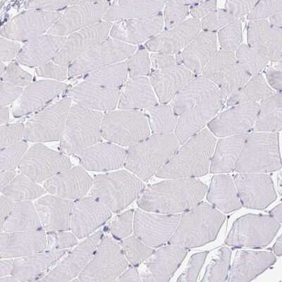 Immunohistochemistry-Paraffin: DNAL1 Antibody [NBP2-13929]