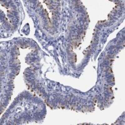 Immunohistochemistry-Paraffin: DNAL1 Antibody [NBP3-17701]