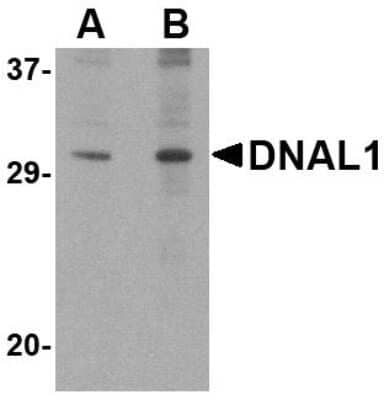 Western Blot: DNAL1 AntibodyBSA Free [NBP1-76932]