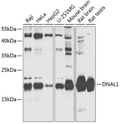 Western Blot: DNAL1 AntibodyBSA Free [NBP2-92704]