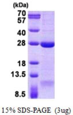 SDS-PAGE: Recombinant Human DNAL1 His Protein [NBP2-23013]