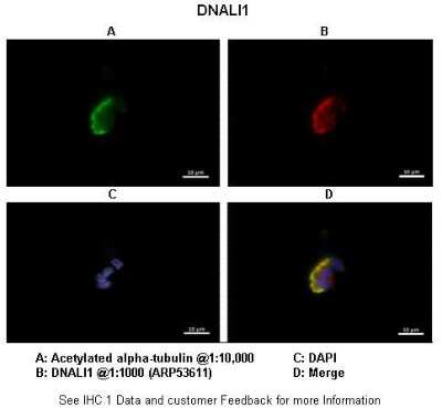 Immunohistochemistry: DNALI1 Antibody [NBP1-56390]