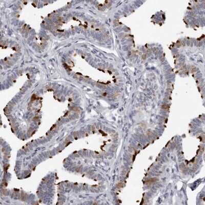 Immunohistochemistry-Paraffin: DNALI1 Antibody [NBP1-84222]