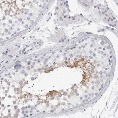 Immunohistochemistry-Paraffin: DNALI1 Antibody [NBP1-84222]