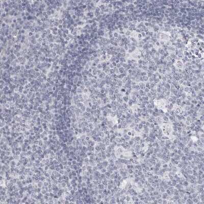 Immunohistochemistry-Paraffin: DNALI1 Antibody [NBP1-84222]