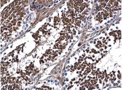 Immunohistochemistry-Paraffin: DNALI1 Antibody [NBP2-16197]
