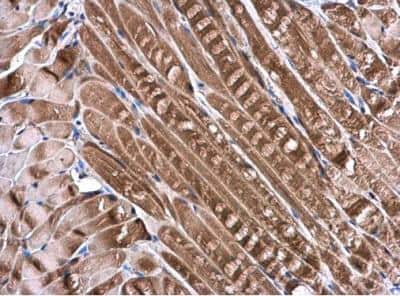 Immunohistochemistry-Paraffin: DNALI1 Antibody [NBP2-16197]