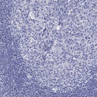 Immunohistochemistry-Paraffin: DNALI1 Antibody [NBP3-17031]