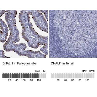 Immunohistochemistry-Paraffin: DNALI1 Antibody [NBP3-17031]