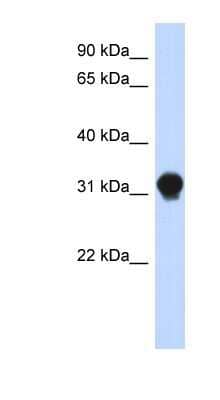 Western Blot: DNALI1 Antibody [NBP1-56390]