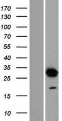 Western Blot: DNALI1 Overexpression Lysate [NBP2-08006]