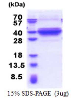 SDS-PAGE: Recombinant Human DNALI1 His Protein [NBP2-23014]