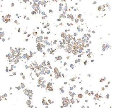 Immunocytochemistry/ Immunofluorescence: DNAM-1/CD226 Antibody (BLR063G) [NBP2-77357]