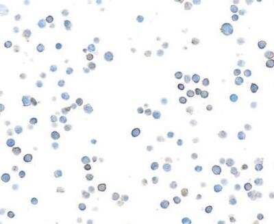 Immunocytochemistry/ Immunofluorescence: DNAM-1/CD226 Antibody (BLR063G) [NBP2-77357]