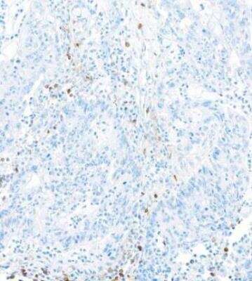 Immunohistochemistry-Paraffin: DNAM-1/CD226 Antibody (BLR063G) [NBP2-77357]