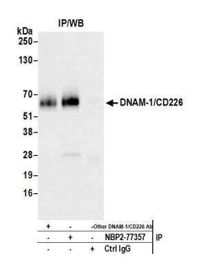 Immunoprecipitation: DNAM-1/CD226 Antibody (BLR063G) [NBP2-77357]