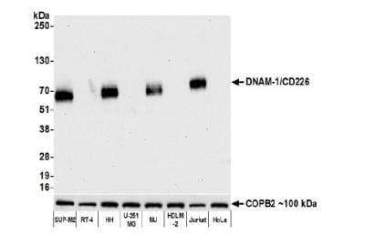 Western Blot: DNAM-1/CD226 Antibody (BLR063G) [NBP2-77357]