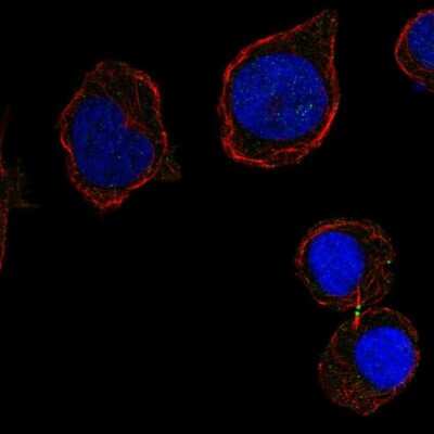 Immunocytochemistry/ Immunofluorescence: DNAM-1/CD226 Antibody [NBP2-68690]